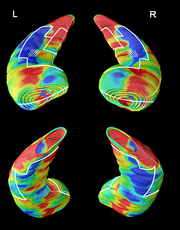 Subiculum CA2-3 L Fimbria CA1 Presubiculum