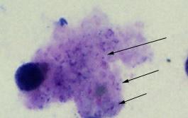 Pneumoncystis nel polmone A livello degli alveoli polmonari Pneumocystis può essere evidenziato nelle due forme di trofozoite e cisti.