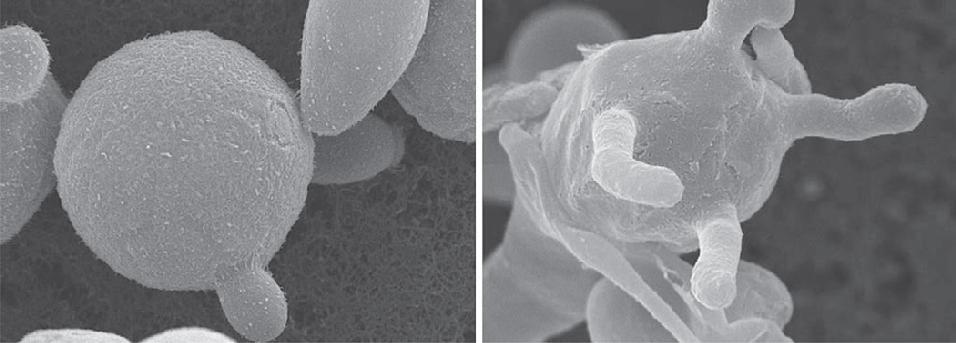 Morphology of C. neoformans budding yeast. Scanning electron microscopy. Dugdale, D. C. (2010, September 15). Meningitis cryptococcal. Retrieved from http://www.ncbi.nlm.nih.