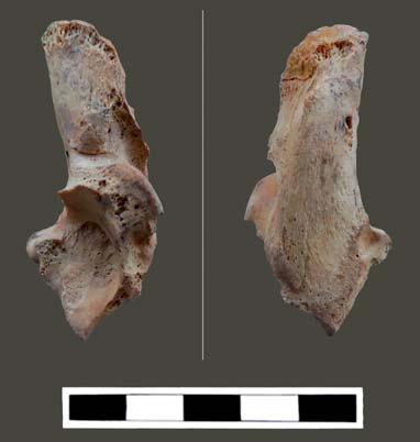 Foto 2 - Calcagno destro patologico di capra, vista mediale (a sx) e plantare.