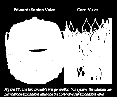 Le valvole di prima generazione sono caratterizzate da un incidenza significativa, in termini di risultati a medio e lungo termine,di