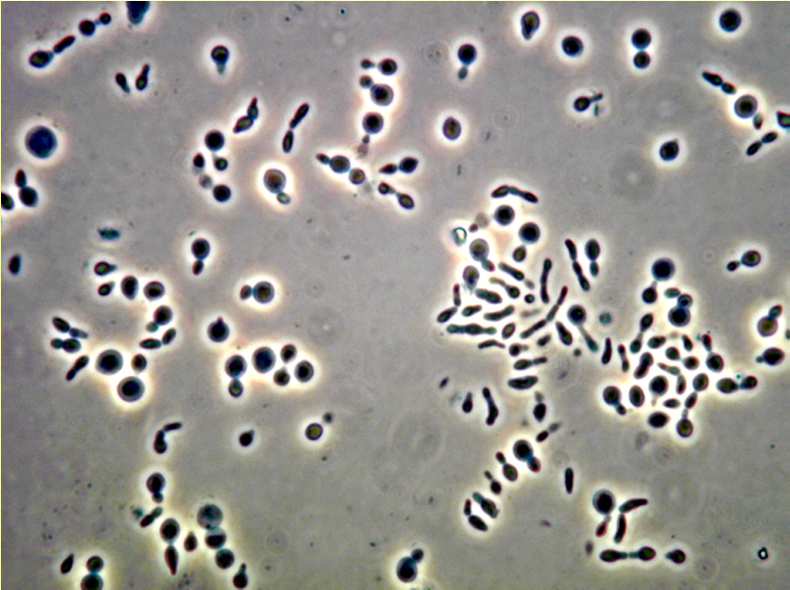 I batteri sono oggetti di fase AMPIEZZA LUNGEZZA D ONDA L entità del valore di cui è diminuita l ampiezza del raggio luminoso determina quanto apparirà scuro un oggetto nel campo microscopico OGGETTO