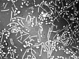 Diagnosi Foto 4: Batteri su larve colpite da peste europea Fino a poco tempo fa, la presenza di M. plutonius veniva rilevata soltanto al microscopio.