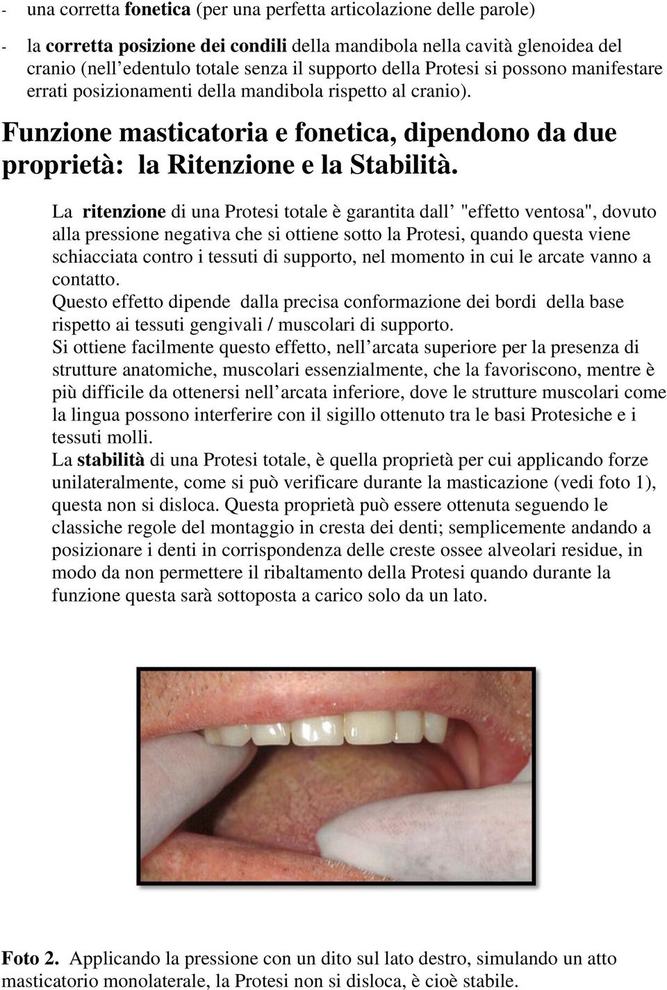 La ritenzione di una Protesi totale è garantita dall "effetto ventosa", dovuto alla pressione negativa che si ottiene sotto la Protesi, quando questa viene schiacciata contro i tessuti di supporto,