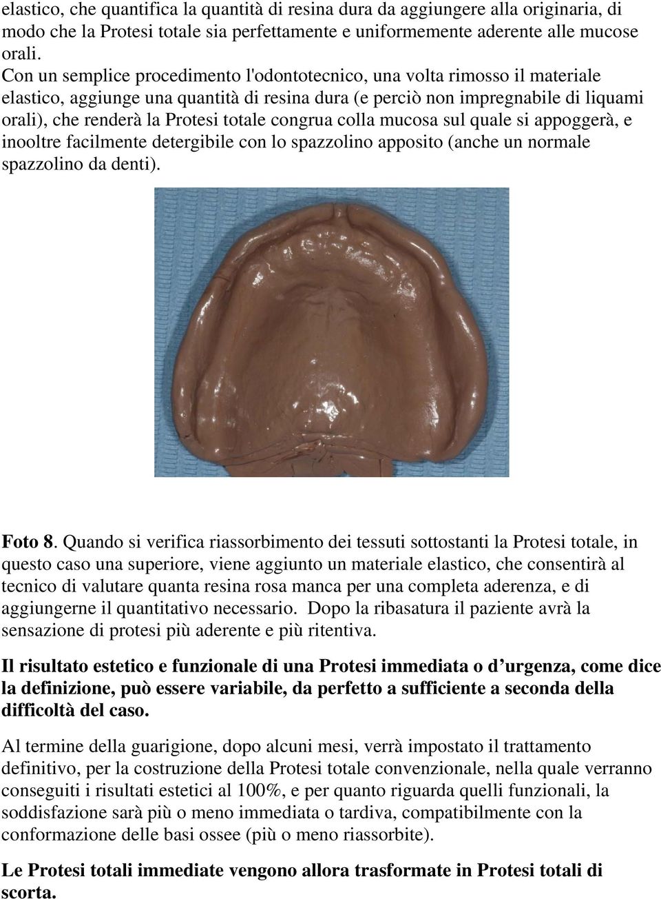 congrua colla mucosa sul quale si appoggerà, e inooltre facilmente detergibile con lo spazzolino apposito (anche un normale spazzolino da denti). Foto 8.