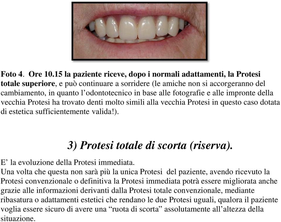 fotografie e alle impronte della vecchia Protesi ha trovato denti molto simili alla vecchia Protesi in questo caso dotata di estetica sufficientemente valida!). 3) Protesi totale di scorta (riserva).