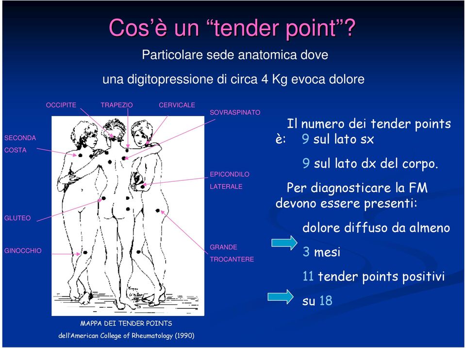 CERVICALE SOVRASPINATO EPICONDILO LATERALE Il numero dei tender points è: 9 sul lato sx 9 sul lato dx del corpo.