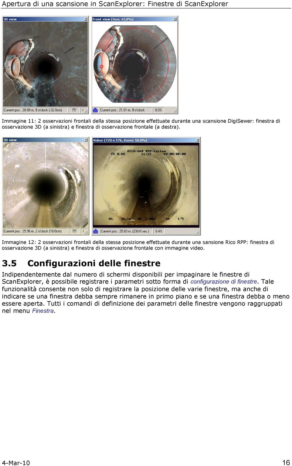 Immagine 12: 2 sservazini frntali della stessa psizine effettuate durante una sansine Ric RPP: finestra di sservazine 3D