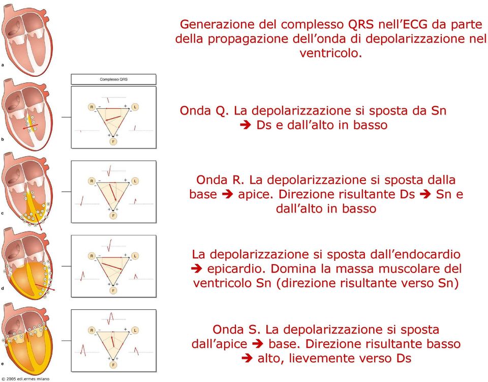 Direzione risultante Ds Sn e dall alto alto in basso La depolarizzazione si sposta dall endocardio epicardio.