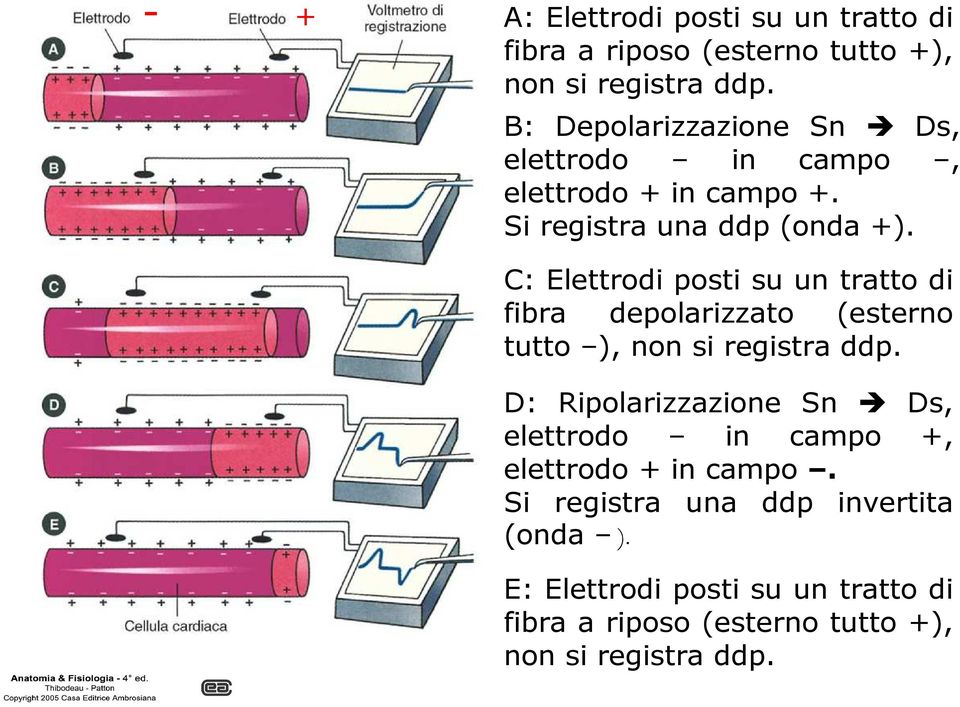 C: Elettrodi posti su un tratto di fibra depolarizzato (esterno tutto ), non si registra ddp.