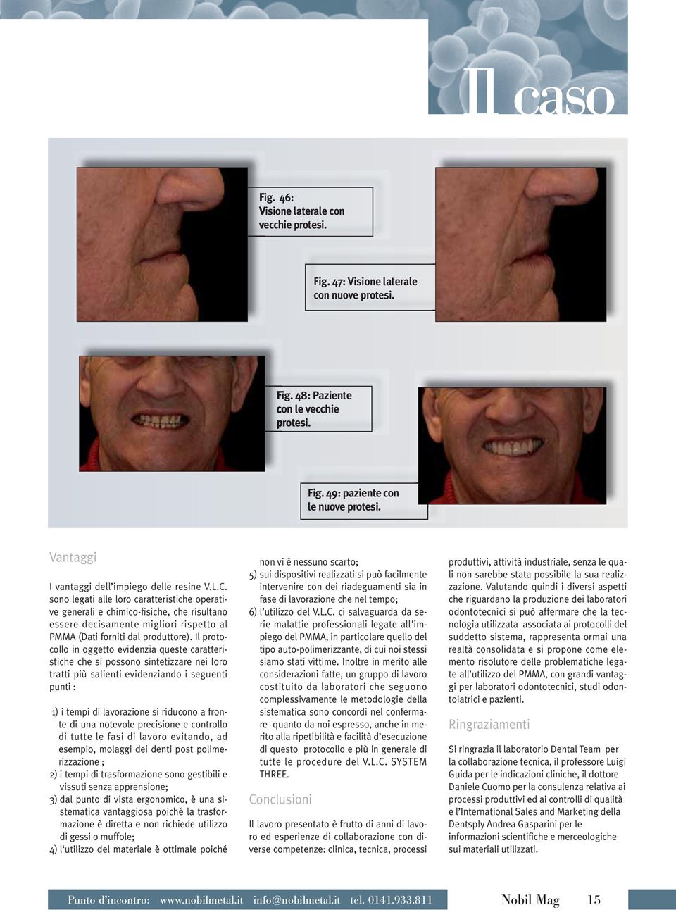 sono legati alle loro caratteristiche operative generali e chimico-fisiche, che risultano essere decisamente migliori rispetto al PMMA (Dati forniti dal produttore).