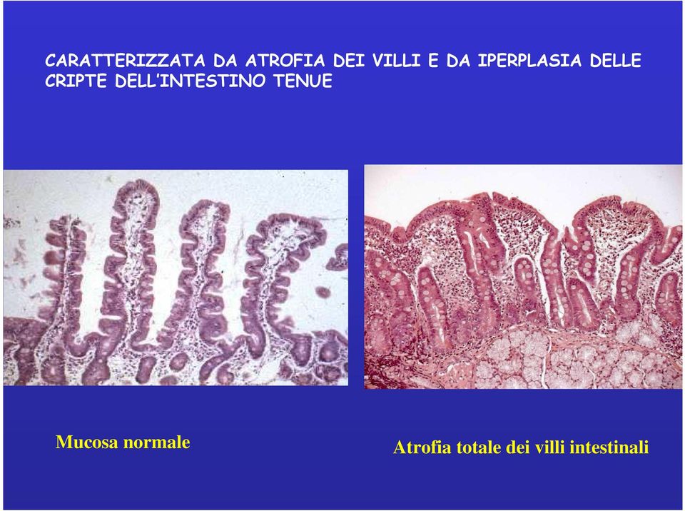 DELL INTESTINO TENUE Mucosa