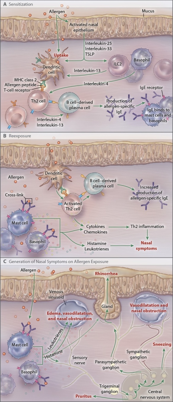 Sensibilizzazione allergica, meccanismo immunologico e origine sintomi nella rinite allergica Panello A: la presentazione dell antigene da parte delle cellule dendritiche contemporaneamente all