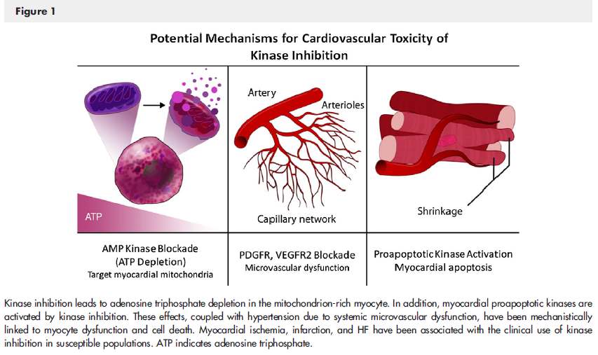 Mechanisms for Cardiotoxicity of VSPi