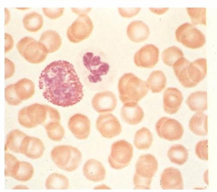 Granulociti eosinofili Restano in circolo solo 6-10 ore poi vanno nei tessuti connettivi Nucleo Due lobi (a