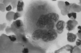 Megacariocito In some cases, the nucleus may contain up to 64N DNA, or 32 copies of the normal complement of DNA in a human cell.