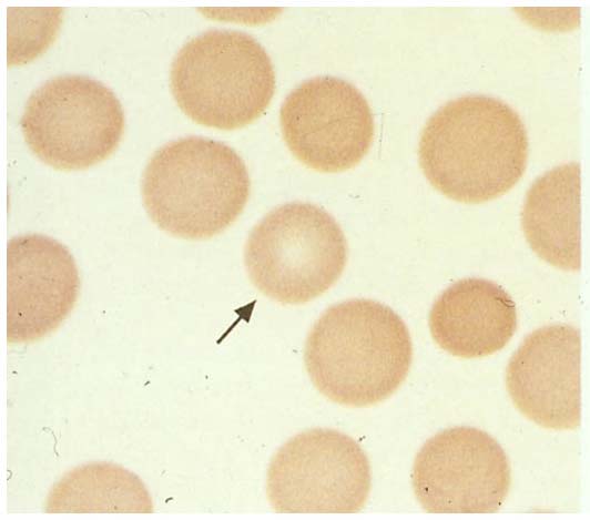 Gli elementi figurati del sangue: gli eritrociti Eritrociti in uno striscio di sangue.