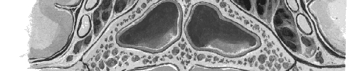 Seno cavernoso Laghi venosi Arteria carotide interna intracavernosa