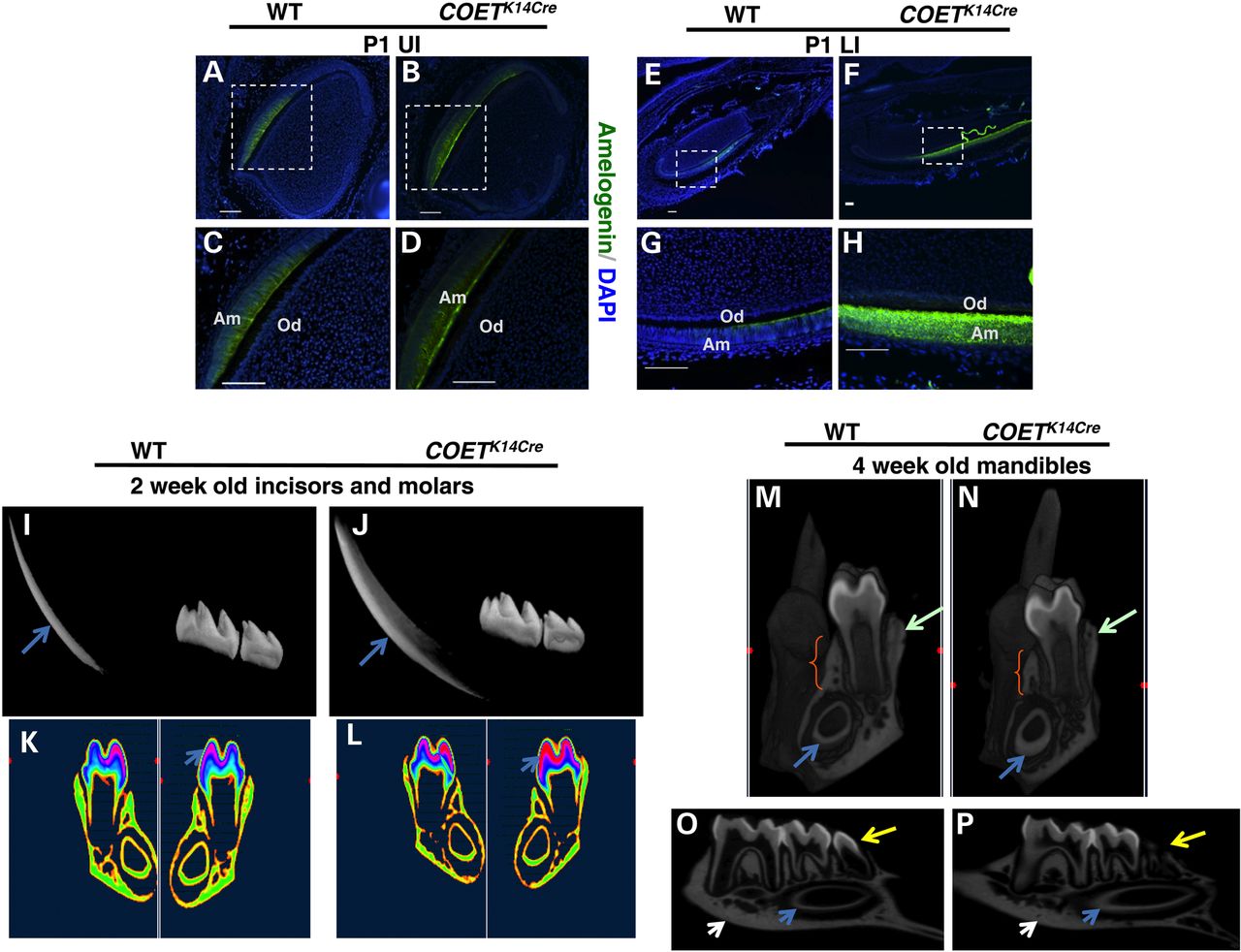 Tbx1 over-expression increases amelogenin, enamel