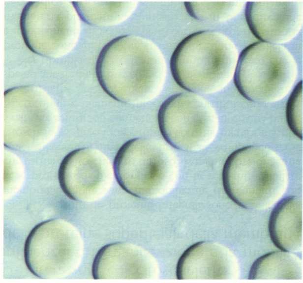 Le cellule del sangue: eritrociti Hanno una forma di lente biconcava con un diametro di 7,5 ųm, uno spessore di di circa 2 ųm e di 1 ųm nella parte centrale Tale forma assicura un miglior scambio