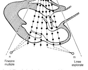 FLUSSIMETRO (Analisi spettrale del segnale doppler) Lo spettrogramma normale di un vaso con flusso laminare (velocità massima al centro e velocità progressivamente decrescente man mano che si