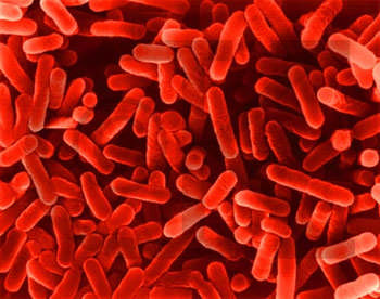 Assortimento Soluzioni efficaci ed economiche per eliminare il pericoloso batterio della Legionella (responsabile di broncopolmoniti dagli esiti