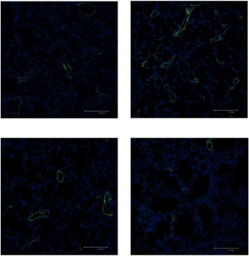 A Controllo Cellule LAM/TSC Ab an<- EGFR Rapamicina B 12 10 *** LVD (even</campo) 8 6 4 ## ## 2 0 1 Controllo Cellule LAM/TSC Ab an<- EGFR Rapamicina Figura 6: Valutazione della linfangiogenesi