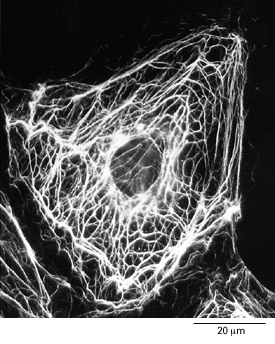I filamenti intermedi (IF) hanno un ruolo fondamentale strutturale, di sostegno della tensione cellulare.