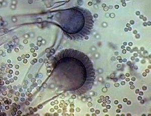 ALLERGENI MUFFE Alternaria alternata e Aspergillus fumigatus