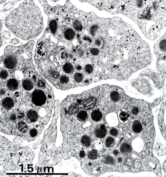 Piastrine Formate mediante trombopoiesi Residui della rottura dei Megacariociti Dimensione 1.5-3.