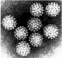 : IPOTESI ETIOPATOGENETICHE HPV LEGAME DI PROTEINE TRASFORMANTI PRODOTTE DAL VIRUS (E6,E7) CON GENI ONCOSOPPRESSORI (p53, RB) Steroidi (Adenoca) Fumo di sigarette Modificazione risposta immune CIN