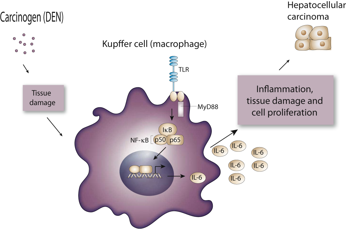 NB: naturalmente fonte di tissue damage é anche epatite conclusioni Le cellule e i mediatori dell infiammazione sono una presenza importante dell ambiente tumorale Lo stato infiammatorio