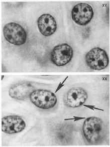 Eterocromatina Costitutiva Eterocromatina costitutiva: rimane nello stato condensato in tutti gli stadi del ciclo cellulare di tutte le cellule DNA permanentemente silenziato.