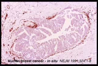 Ca in situ e