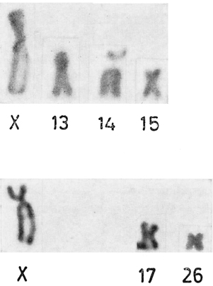CARIOLOGIA DEI RINOLOFIDI 369 e tuttavia difficile supporre dei meccanismi di mutazione cromosomica capaci eli conferire loro le caratteristiche morfologiche di una coppia di elementi dell' altra