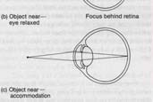 Vergenza Angolo formato dagli occhi relativo al centro della testa Convergiamo gli occhi quando guardiamo ad oggetti vicini Li divergiamo quando guardiamo oggetti lontani Vergenza L angolo tra le