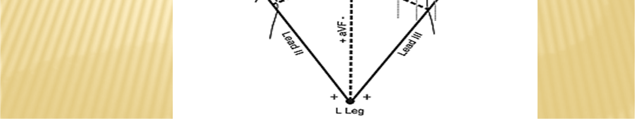 Collocando gli elettrodi agli arti si ottiene idealmente un triangolo. Ogni lato del triangolo è formato da due elettrodi e rappresenta una derivazione toracica.