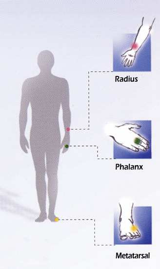 ULTRASONOGRAFIA Eseguita su calcagno, metatarsi piede, rotula, tibia, falangi della mano, polso Utilizzata come screening di accesso alla