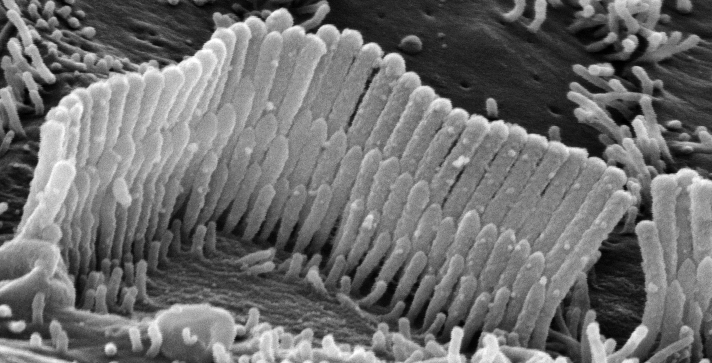 Oltre all elettromotricità, le OHC isolate presentano altre caratteristiche contrattili: in particolare la contrazione lenta calciodipendente che modula l elettromotricità controllata del sistema