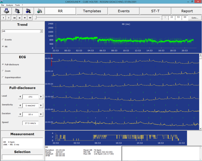 cubeholter cubeholter è la soluzione completa per la gestione dell esame Holter ECG.