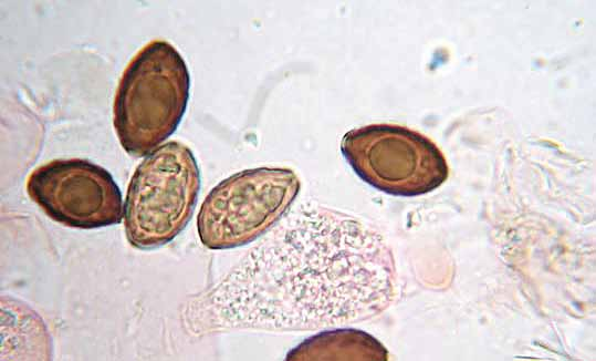 Parco naturale Bosco delle sorti della partecipanza - Trino Microscopia Spore (foto in alto) 13-15,5 7-9 µm, da amigdaliformi a ellissoidali, verrucose, da immature con grossa guttula, poro