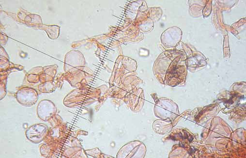 Parco naturale Bosco delle sorti della partecipanza - Trino Microscopia Spore 8-9(10) 4,5-6 µm, ellissoidali, mitriformi con base larga e poro germinativo centrale.