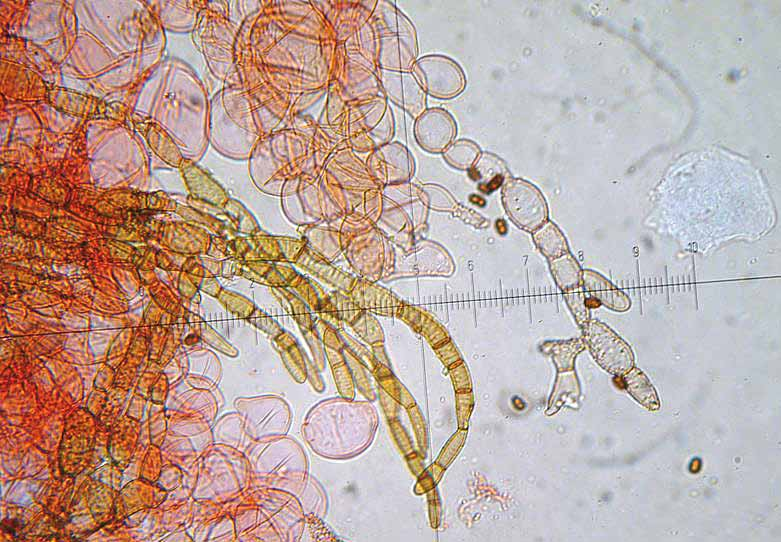 Parco naturale Bosco delle sorti della partecipanza - Trino Microscopia Spore (foto in alto) 7-9,5 4,5-5,5 µm, faseoliformi, con poro germinativo. Basidi (foto in alto) clavati, tetrasporici.