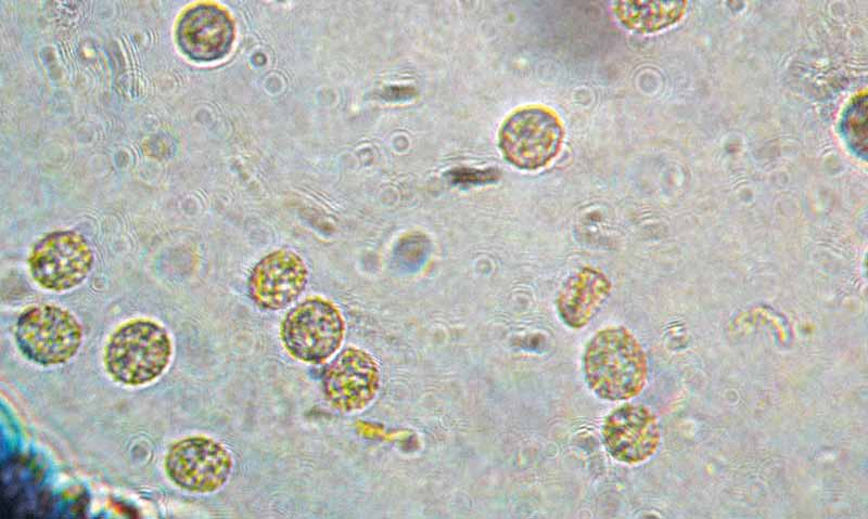 Parco naturale Bosco delle sorti della partecipanza - Trino Microscopia Spore 7,5-9,8(10,5) 6-8(8,5) µm subglobulose,ovoidali o largamente ellissoidali, aculei corti