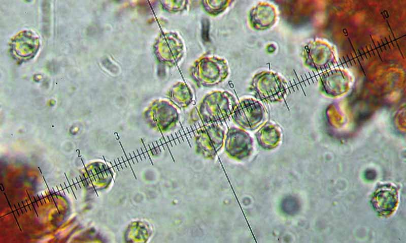 Parco naturale Bosco delle sorti della partecipanza - Trino Microscopia Spore 7-9(9,5) 6-7 (8) µm, semiglobose, verrucose, con aculei oltre il micrometro, con connessioni che formano un reticolo a