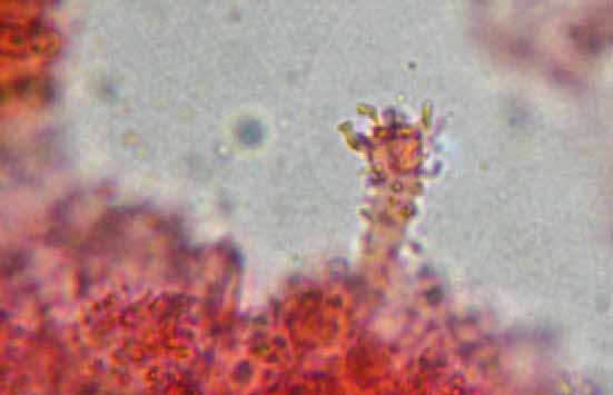 Parco naturale Bosco delle sorti della partecipanza - Trino Microscopia Spore bianche fusiformi misure 8-10 4 µm, basidi tetrasporici (foto in alto), cheilocistidi clavati lunghi