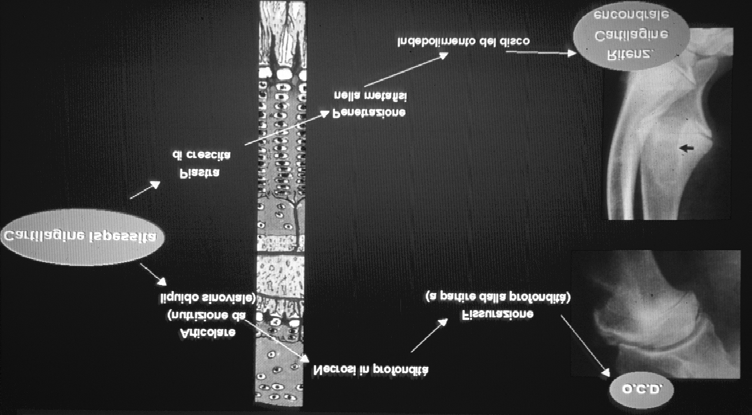 Concetti patogenetici centrali dell osteocondrosi Eziologia dell osteocondrosi L inquadramento eziologico dell osteocondrosi è lontano dall essere completato Fattori individuati Rapida crescita