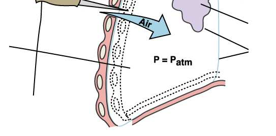 L esistenza di forze elastiche uguali e contrarie è dimostrato dal fatto che quando entra aria nello spazio pleurico (pneumotorace), il polmone collassa e la gabbia toracica si espande.