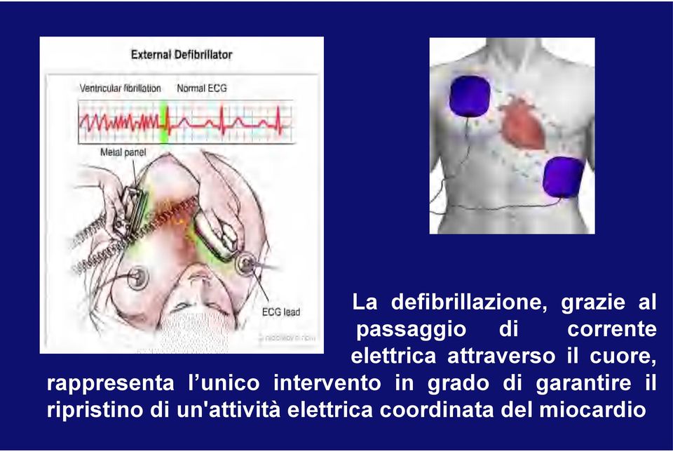 rappresenta l unico intervento in grado di