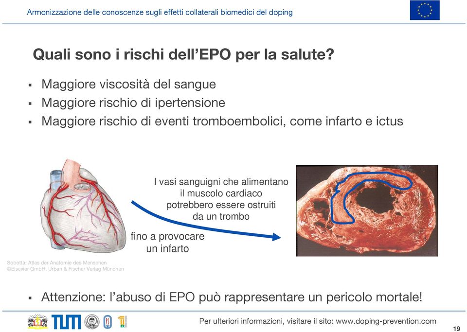 infarto e ictus Sobotta: Atlas der Anatomie des Menschen Elsevier GmbH, Urban & Fischer Verlag München I vasi